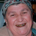 Goldenteeth